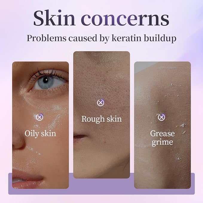 Exfoliating Peeling Gel, Acid Peel Face & Body Exfoliant Scrub, Soft Skin Cleansing Wash, Remove Dead Skin Cells for Men and Women(1 box per pack)