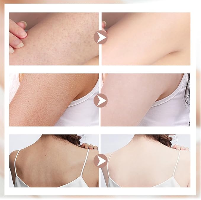 Super Soft Sunflower Suction Cup Bath Ball, 2025 New 2-in-1 Sunflower Bath Ball Exfoliating Bath Sponge Cleaning Brush, Sponge Mesh Pouf Shower Ball for Women, Men Shower (Mix-4Pcs)