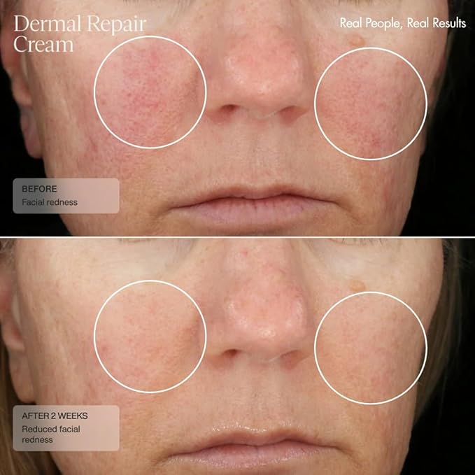 Senté The Repair Duo with Bio Complete Serum & Dermal Repair Cream - AntiAging Skincare Kit for Sensitive Skin, Fine Lines & Wrinkles, Redness & Deep Hydration.With Retinol & Vitamin E(1.0oz & 1.7oz)