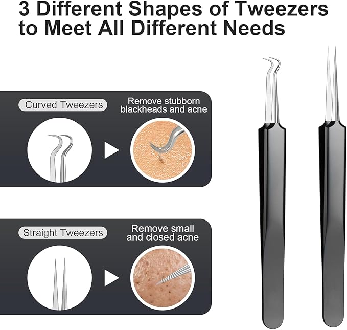 7PCS Blackhead Remover Comedone Extrator Kit, Pimple Extractor Acne Removal Tool Kit, Curved Blackhead Tweezers Kit, Comes with Alcohol Tablets and Magnifying Glasses for Blemish Removal (Iron Box)