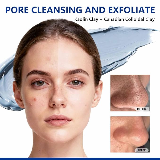 Deep Cleansing Blue Clay Mask for Face, Kaolin Clay Masks for Blackheads and Pores with Niacinamide for Even Out, Hydrating Mud Mask with Brush for All Skin Types（5.3 oz）