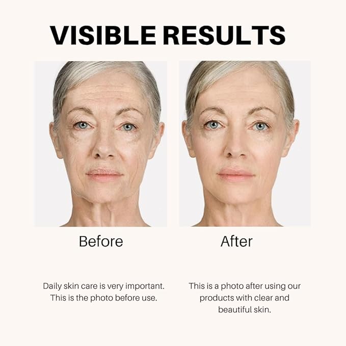 Anti-Aging Lifting & Firming Cream – 1.7 fl oz / 50 ml – Hydrating & Tightening for All Skin Types – Paraben-Free, Fragrance-Free, BHA-Free