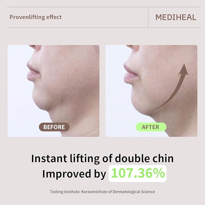 Mediheal Retinol Collagen Cream Lifting Mask (4 Counts) for V Line Mask,Anti-Aging - Helps Reduce Fine Lines & Wrinkles, and Smoothens Skin