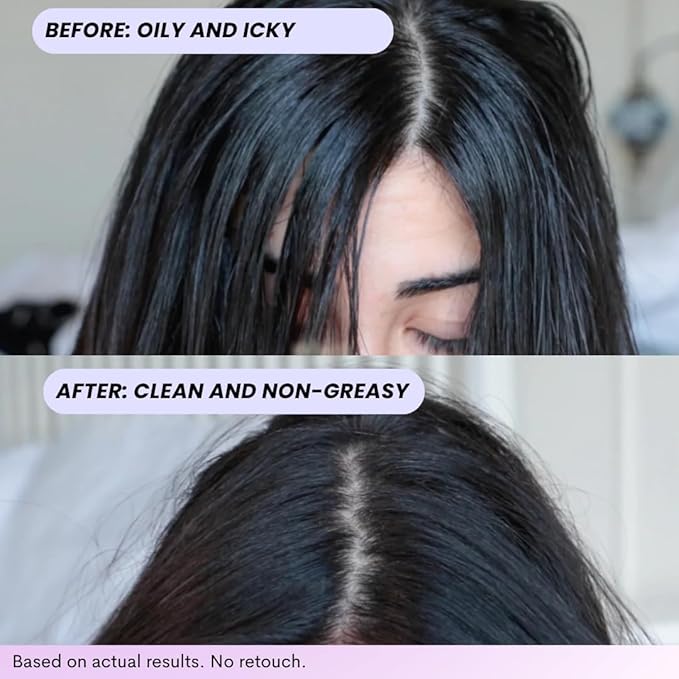 FoxyBae Turned Up Dry Shampoo Spray - Dry Shampoo for Women with Biotin for Hair Growth - Volumizing, Refreshing & Non-Toxic - 7 Fl Oz