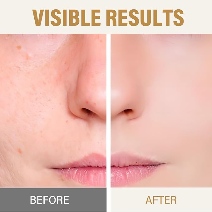 Black Rice Peeling Ampoule, Rice Exfoliating for Smooth, Healthy-Looking Skin | Dead Skin Cell Remover, Gentle Skin Polisher for Face & Body