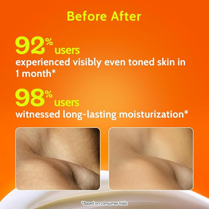 Chemist at Play AHA Body Lotion with 5% Natural AHA, Niacinamide, Shea Butter | For Exfoliating Dry & Dead Skin Cells, Deep Nourishment & Radiant Skin | Skin Brightening Lotion | 236ml