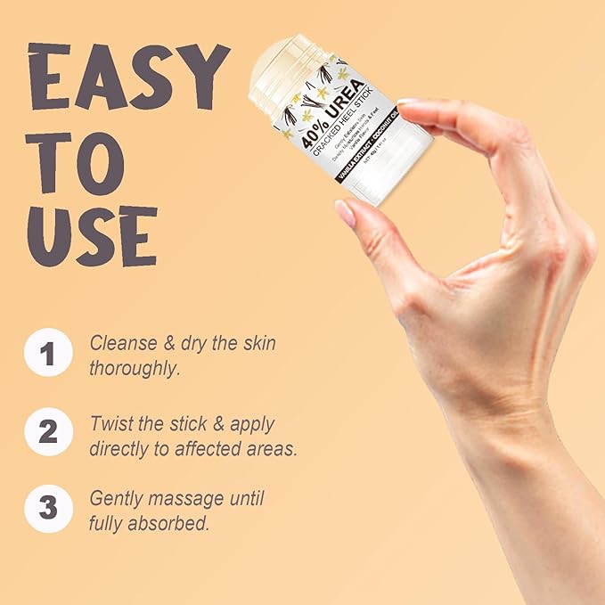 Urea Cream 40 Percent for Dry, Cracked Heels and Feet with Coconut Oil & Vanilla Planifolia, Callus Remover and Skin Softener, Maximum Strength Foot & Hand Cream – 1.41 oz