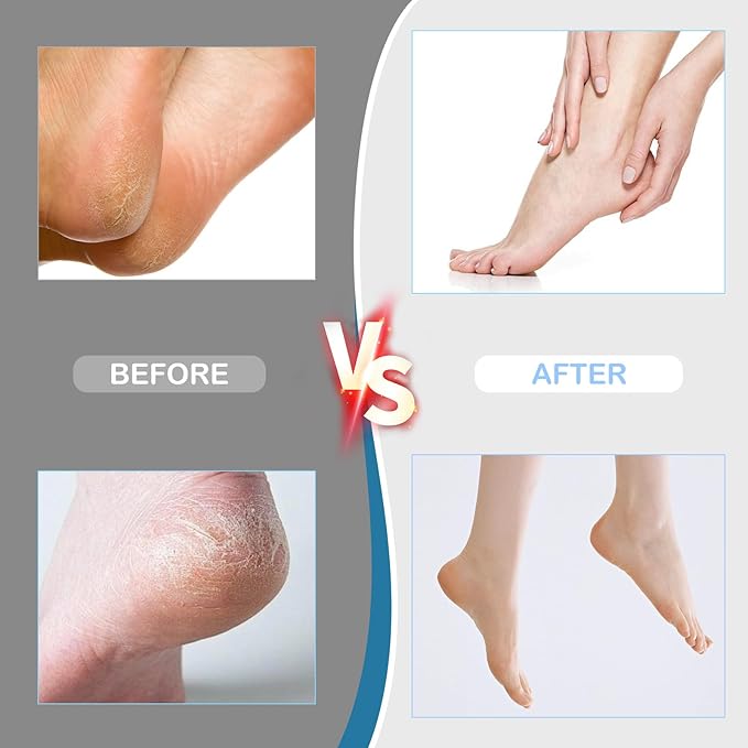 Electric Foot Callus Remover,Powerful Electric Foot File, Professional Adjustable Speed Pedicure Tool with 60 Pcs Replacement Sandpaper Discs for Dead Skin and Calluses-Black