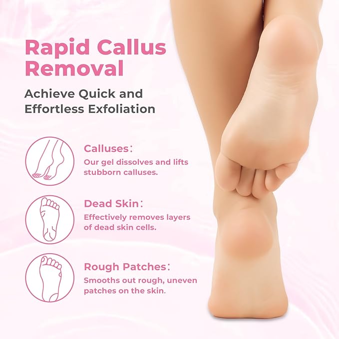 Foot Callus Remover with Foot File, Extra Strength Callus Remover Gel with Brush Head, Professional Dead Skin Removal for Feet, 8oz