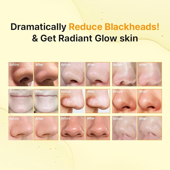 Hanskin Pore Cleansing Oil, Oil Cleanser for Face, Makeup Blackhead Sebum Remover, Korean Deep Pore Cleanser for Sensitive Skin [PHA] (10.14 oz)