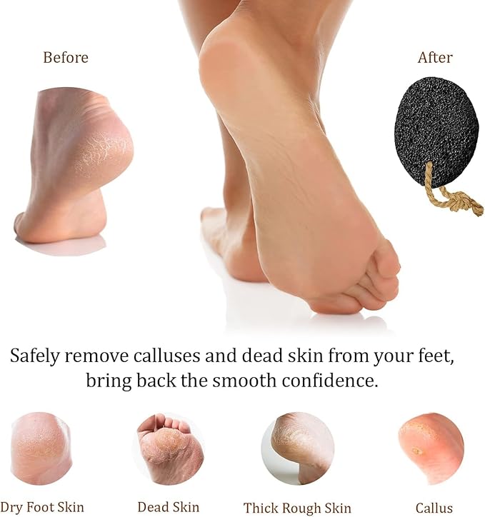 Foot Care Callus Remover Set 3 Pcs - Pumice Stone - Feet File Scrubber -Foot Balm Lavender 3.5 Oz