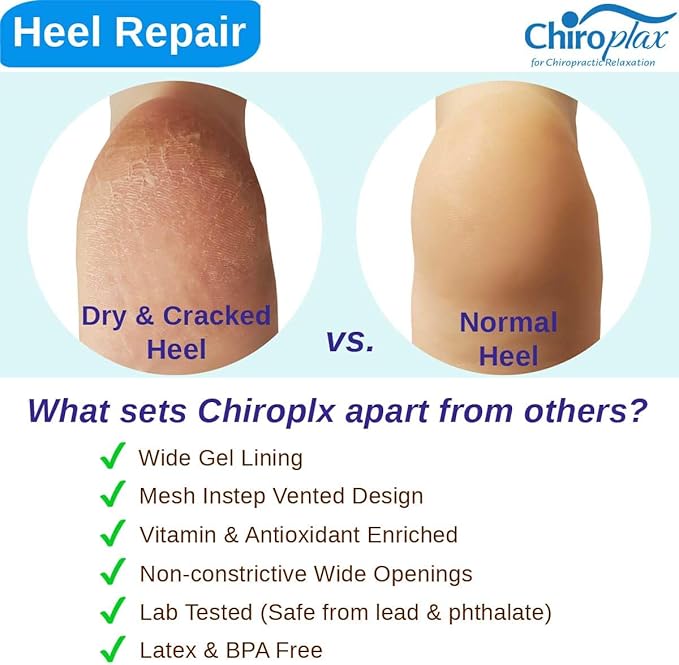 Chiroplax Vented Moisturizing Socks for Dry Cracked Heels Feet Treatment Gel Lined Spa to Repair Heal Soften Calluses Overnight, 2 Pairs (Mint)