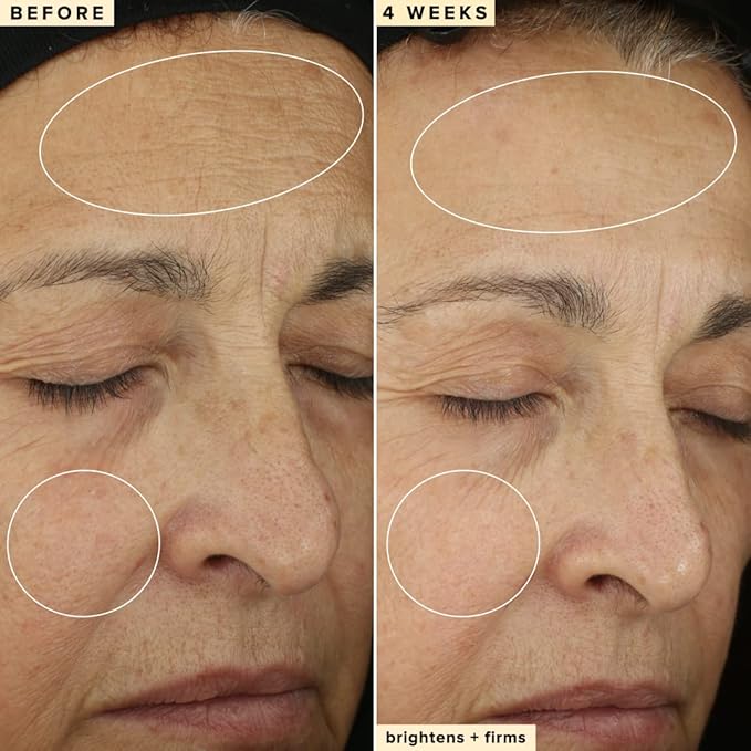 Farmacy Vitamin C & Retinol Serum Bundle - Waterless Vitamin C Face Serum & 1% Vitamin A Resurfacing Retinol Serum