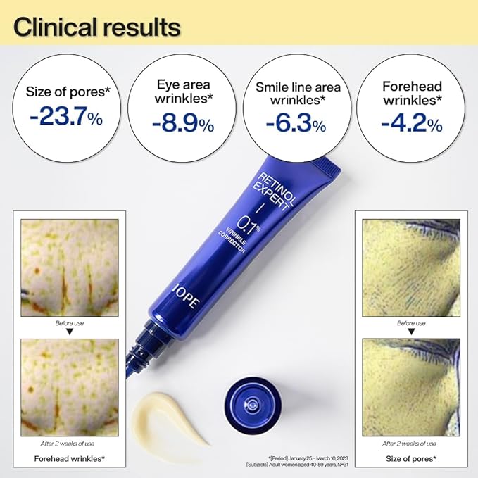 IOPE Retinol Expert 0.1% Anti-Aging Serum, Gel Mask 6 Sheets Set, Daily Self Care Essential Kits, Korean Skincare Glow