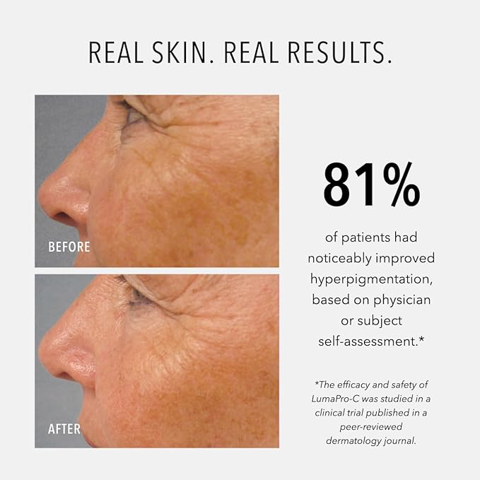 HydroPeptide LumaPro-C Face Serum, Peptide & Pigment Complexion Corrector, Nourish Skin, 1 Ounce