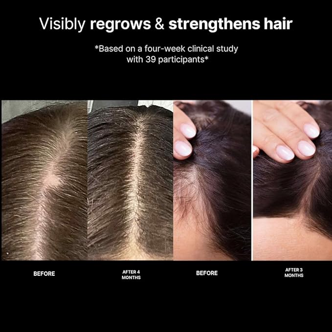 MAXDAHLIA Root Bloom All-Natural Hair Growth Serum with Ashwagandha, Rosemary, Castor Oil, White Willow Bark, Green Coffee Oils for Hair Restoration and Hair Growth