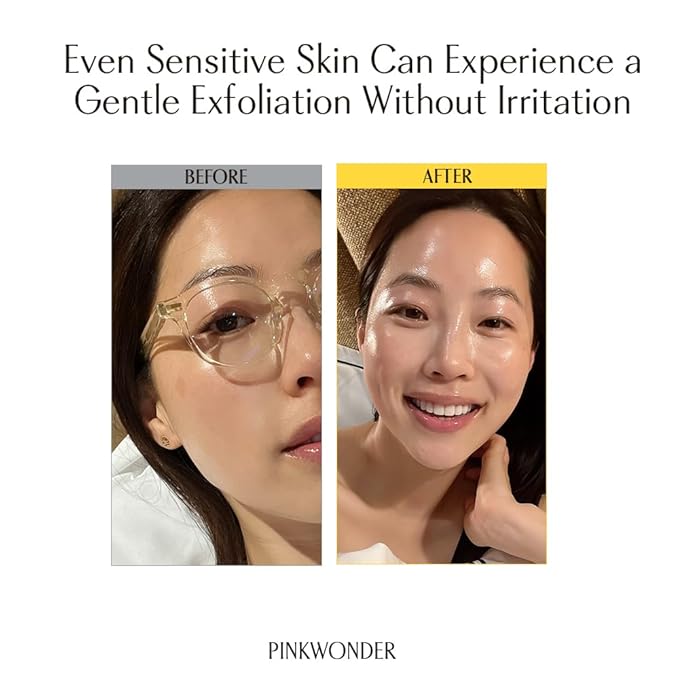 PINKWONDER Jojoba Mochi Vation™ Mud Clay Mask 3.17oz (90g), Organic Jojoba Oil, Blackhead Remover, Clay Detox, Pore Minimizing Wash Off Face Mask