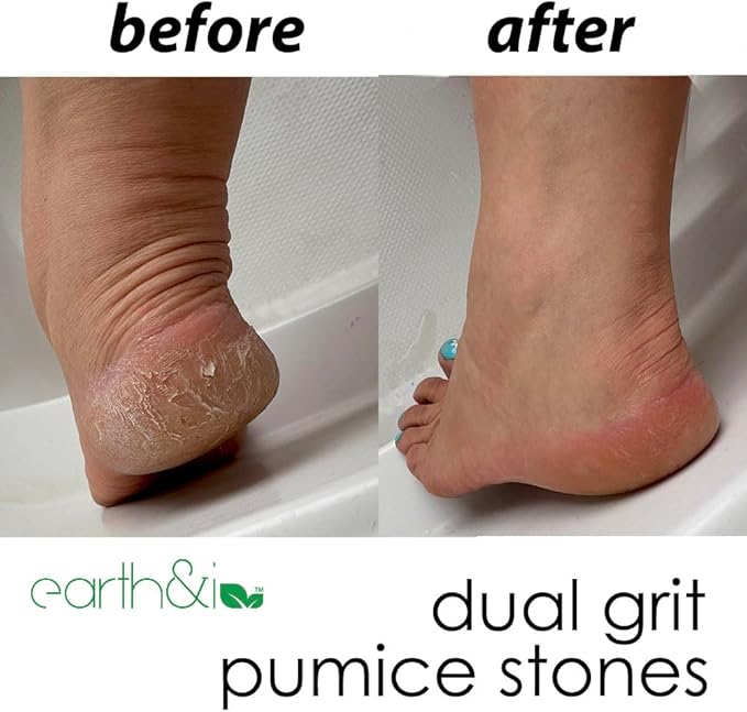 Earth & I Foot Stone Pumice 2 Grits, 2ct, Heel Exfoliator for Feet, Pumice Stone Feet, Heel Scrubber, Pedicure Callus Remover, Pumice Sponge for feet, feet Scrubber, feet Dead Skin Remover, Foot File