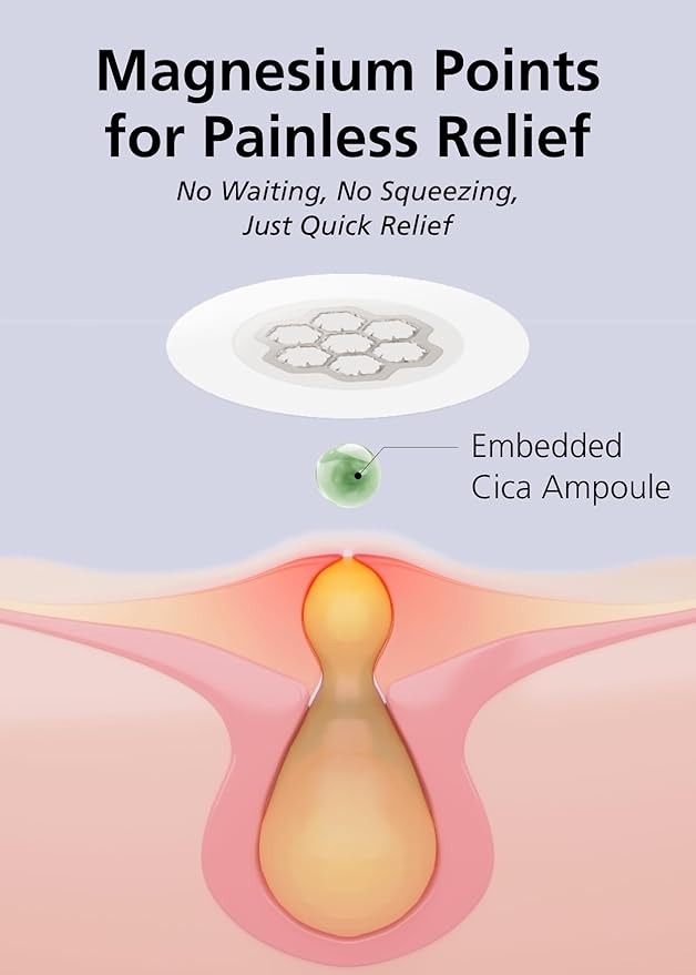 EasyDerm Quick Calming Magnesium Patches – Hydrocolloid Acne Spot Treatment Includes Tweezers & Ampoule, 10 Patches, Zit Sticker, Made by Daewoong Pharmaceutical