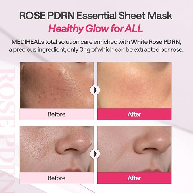 Mediheal Rose PDRN Essential Sheet Mask 10 pcs. 99% Pure White Rose PDRN & Hyaluronic Acid for hydrating, firming, and enhancing moisture barrier, skin firmness, and glow. Vegan formula