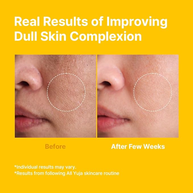 FARMSTAY Citrus Yuja Vitalizing Serum – Vitamin C Glowing Serum with Niacinamide for Dry & Sensitive Skin, Moisturizing & Rejuvenating Radiant Skin Care, Korean Skin care, for Women & Men, 3.38 fl oz