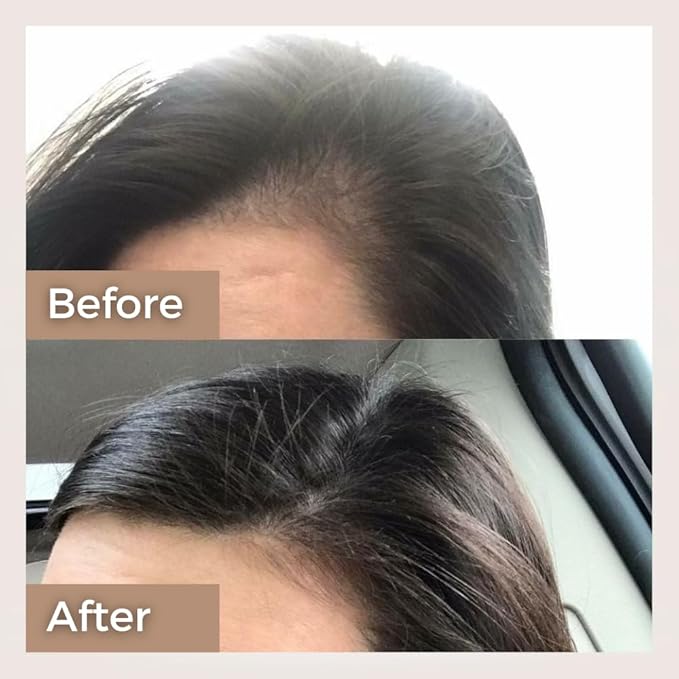 The Tribe Concepts Onion Hair Oil For Hair Growth Hair Fall Control With Almond And Coconut Oil, 100 ml Pack of 1 Clear