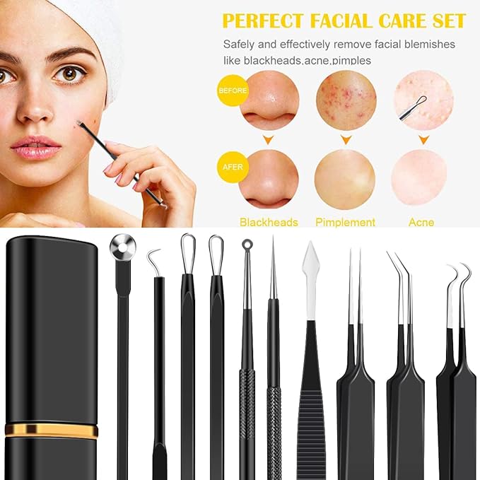 10pcs Pimple Popper Tool Kit Stainless Steel Blackhead Remover Tool Comedones Extractor for Forehead Facial Nose Lightweight Acne Needle Tool with Metal Case for Travel Home Use