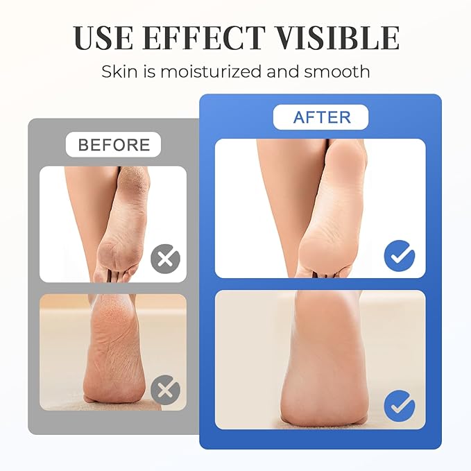 Hydrating and Anti-Cracking Foot Cream, 2025 Moisturising and Relieves Cracking and Dryness Foot Cream, Hand and Foot Repair Cream for Women & Men Callused, Feet, Knee, Elbow, Hand (White-2PCS, #01)