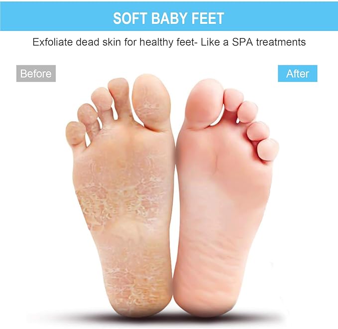 BESKAR Larger Shower Foot Scrubber Mat with Non-Slip Suction Cups- Cleans, Smooths, Exfoliates & Massages your Feet Without Bending, Improve Foot Circulation & Soothes Tired Feet- Black