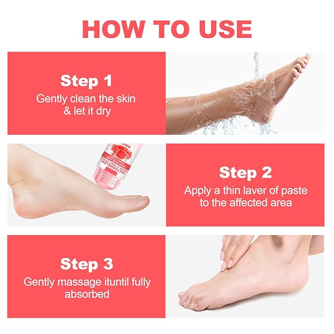 60% Urea Cream Foot Hand Cream Stick for Cracked Hands Elbows Feet Knees, Balm for Dry & Dead Skin, Hydrates & Nourish Foot Care for Women & Men, Watermelon Scent, 1.41 oz