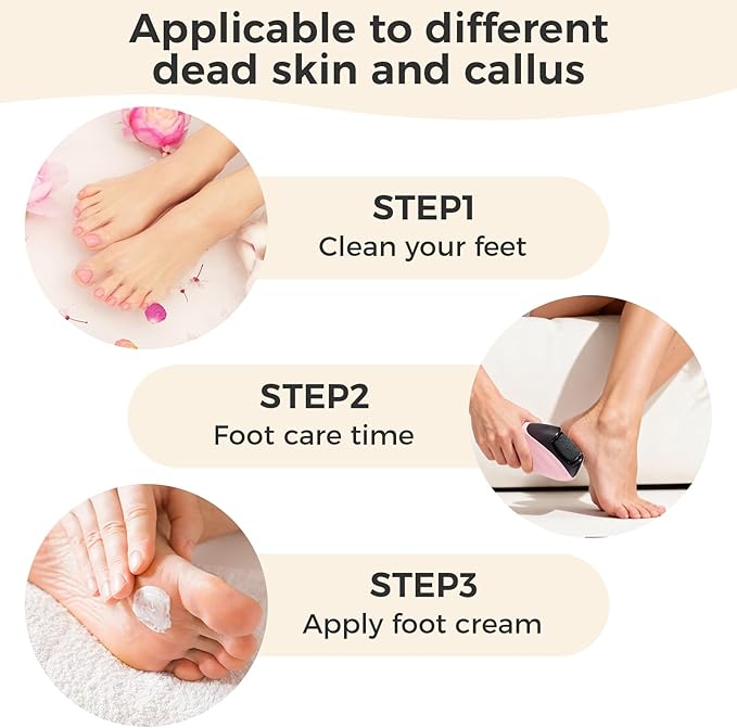 Foot Callus Remover｜Patented 3D Roller + 2-Speed 丨LED｜30,000 RPM High-Frequency Exfoliation｜Portable for Home & Travel｜Stylish Foot Care for Men & Women (Pink)