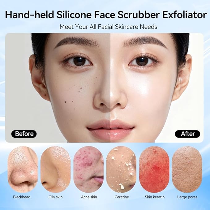 Facial Cleansing Brush, Face Scrubber, Electric Face Brush with 7 Colors, Rechargeable Waterproof Exfoliator with Heat and Vibration, Deep Cleansing and Massage for Men and Women(Black)