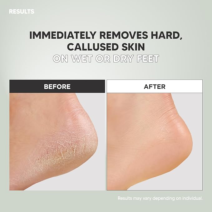 S-Line Emery Foot File, Colossal Double-Sided Pedicure Tool, Effective for Cracked Heel, Ergonomic Design for Easy Grip (2Pcs)