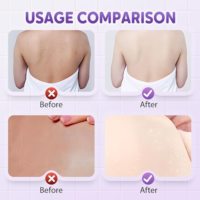 Super Soft Sunflower Suction Cup Bath Ball, 2025 Upgraded Bath Sponge Cleaning Brush Exfoliating Bath Sponge Cleaning Brush, Multi-color Mesh Pouf Sponge Mesh Shower Ball for Women, Men Shower (4 Pcs)