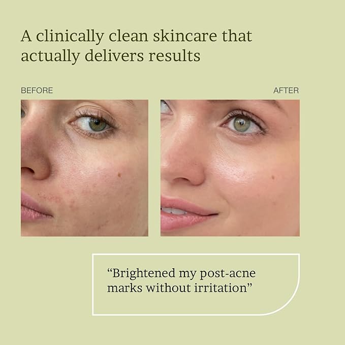 MAXDAHLIA Cell Active Day Serum | 10X Antioxidant Protection | Small-Batch Non-Oxidizing 20% Vitamin C+E Ferulic Acid with Niacinamide & Hyaluronic Acid | Anti-Aging, Brightening, Dark Spot Corrector