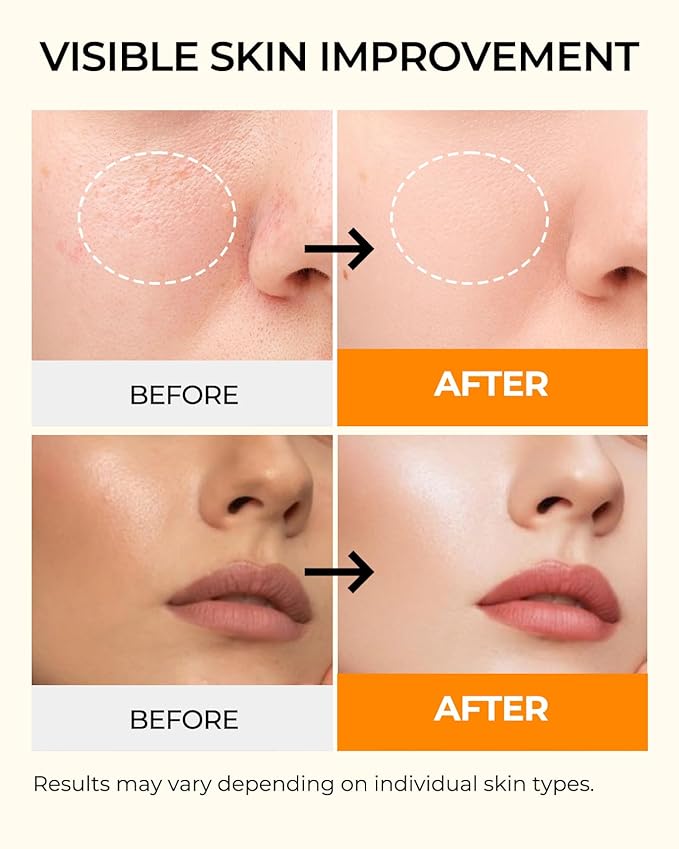 6 Sheet Masks Kojic Acid Turmeric Face Mask Even Skin Tone, Elasticity, Radiant, Moisturizing, Hydrating Face Masks for Dull Skin Facial Mask Controlling Oil and Refining Pores Facemask Skincare