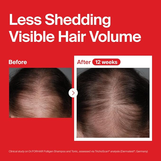 Dr.FORHAIR Folligen Tonic | Scalp Serum for Hair Care | Scalp Care and Nourishment | Revitalizing Tonic for Healthy Scalp & Hair Thickening, 4.06 fl oz