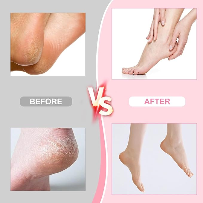 Electric Foot Callus Remover,Powerful Electric Foot File, Professional Adjustable Speed Pedicure Tool with 60 Pcs Replacement Sandpaper Discs for Dead Skin and Calluses-Pink