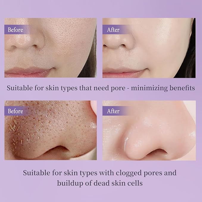 Exfoliating Peeling Gel, Acid Peel Face & Body Exfoliant Scrub, Soft Skin Cleansing Wash, Remove Dead Skin Cells for Men and Women(1 box per pack)