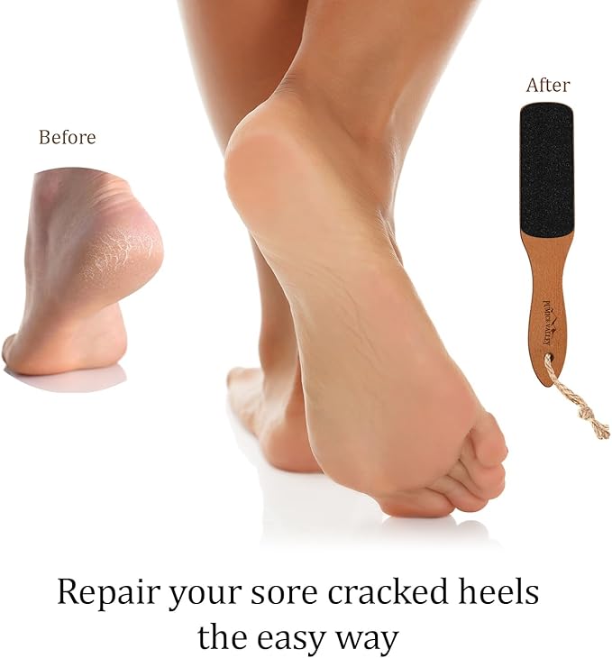 Foot File with Handle Pumice Stone for Dry Dead Skin - Callus Remover for Feet Double-Sided Foot File for Callus, Cracked Heels, Dead, and Dry Skin Removal
