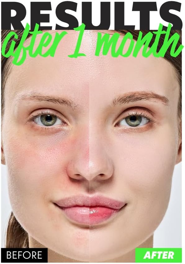 Fation Nosca9 Soothing Toner S | 2% PHA & LHA Exfoliating Toner for Sensitive Skin | Moisturizing, Hypdrating & Quick Absorption Korean Skincare (Pack of 1, 6.76 Fl Oz)