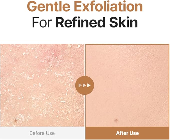 PURITO Oat PDRN Gentle Refining Toner 200 mL 6.76 fl.oz, Korean Oat Exfoliating Toner 99% Pure Oat PDRN, Hydrating & Clarifying Formula for Acne-Prone Skin, Vegan, Non-Comedogenic, Gentle Daily Use