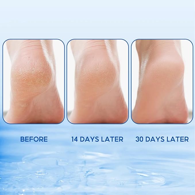 Foot Care Stick for Dry Cracked Feet, Knees, Elbows, Hands,Moisturizes and Hydrates the Dry Ski -1 Ounce (Pack of 2)