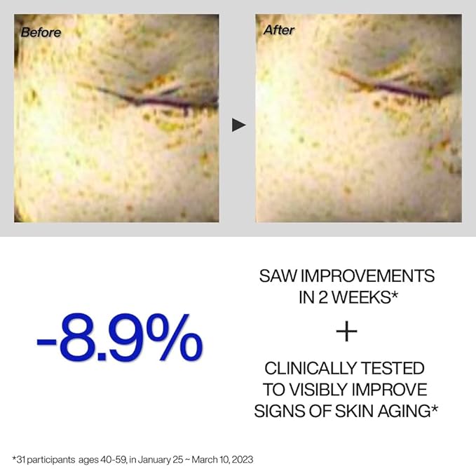 IOPE Retinol Expert 0.1% Anti-Aging Serum, Gel Mask 6 Sheets Set, Daily Self Care Essential Kits, Korean Skincare Glow