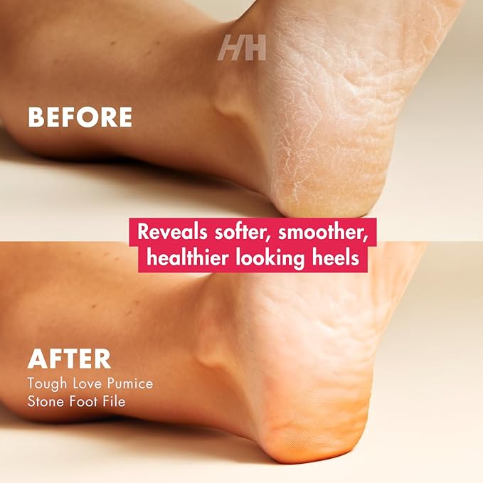 Handmade Heroes Foot Exfoliator - Deep Skin Smoother for Dry, Rough Areas & Cracked Heels – Natural Scrub for Silky Soft Skin
