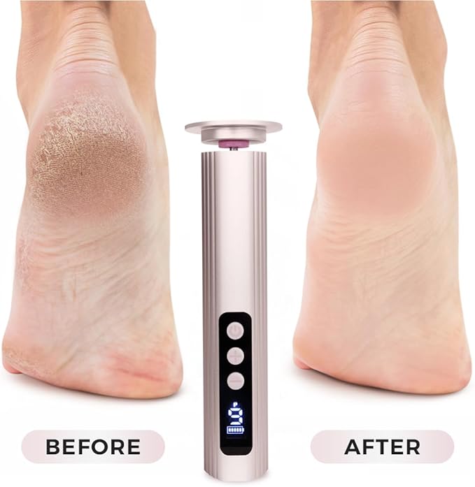 Electric Foot Callus Remover with Nano Glass Head, 9-Speed Rechargeable Foot File with Adjustable R/F Rotation, Digital Display & Powerful Motor for Cracked Heels & Dead Skin (Pink)