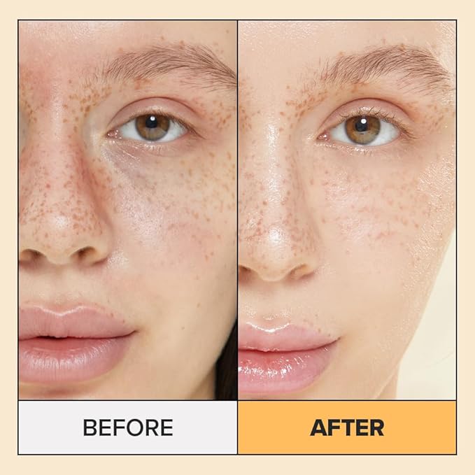 I DEW CARE Calendula Sheet Face Mask - Korean Skincare for Hydrating and Calming Skin | Face Masks with Calendula Extract & Niacinamide, Moisturizing, Sheet Masks for Women, Cute Stuff, 10EA