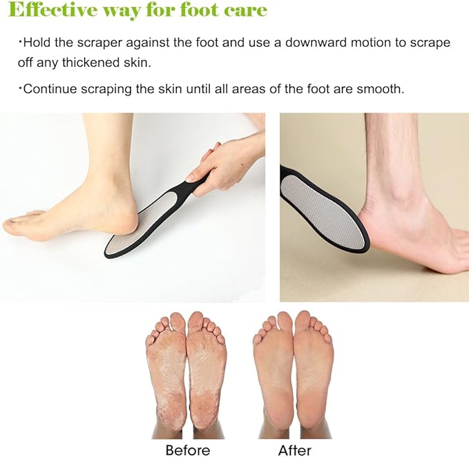 BEZOX Foot File (1 PCS), Double Sided Foot Scraper Callus Remover, Foot Rasp for Cracked Heel and Foot Corn Removal, Stainless Steel Pedicure File W/Cloth Storage Bag