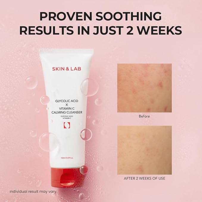 [SKIN&LAB] Glycolic Acid X Vitamin C Calming Cleanser, 5.07 fl. oz.