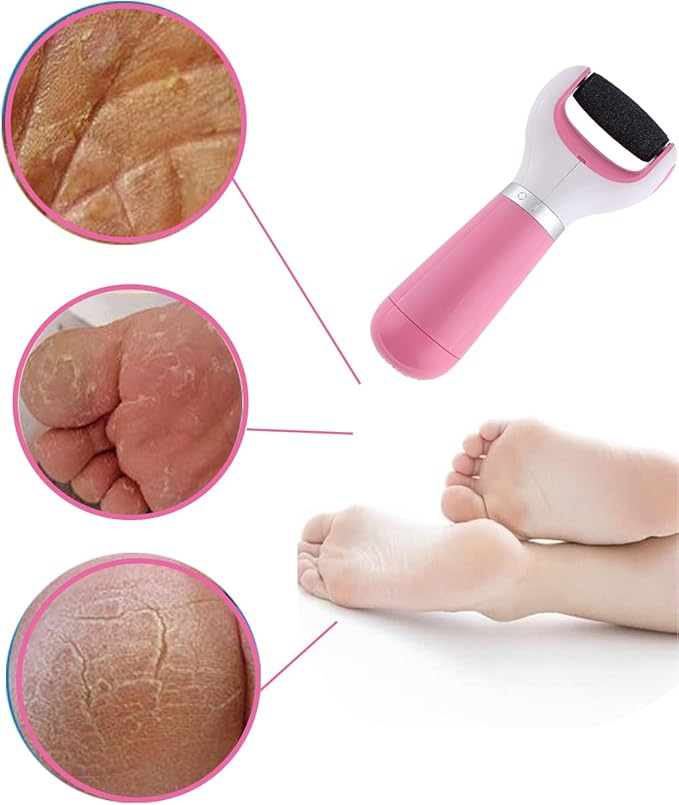 Electric Callus Remover for Feet Callus Remover Foot Callus Remover Tool Foot Buffer Electric Foot Calloused Feet Remover Tool Pedicure Supplies USB Charging and Battery Power＋1 Roller（Pink）